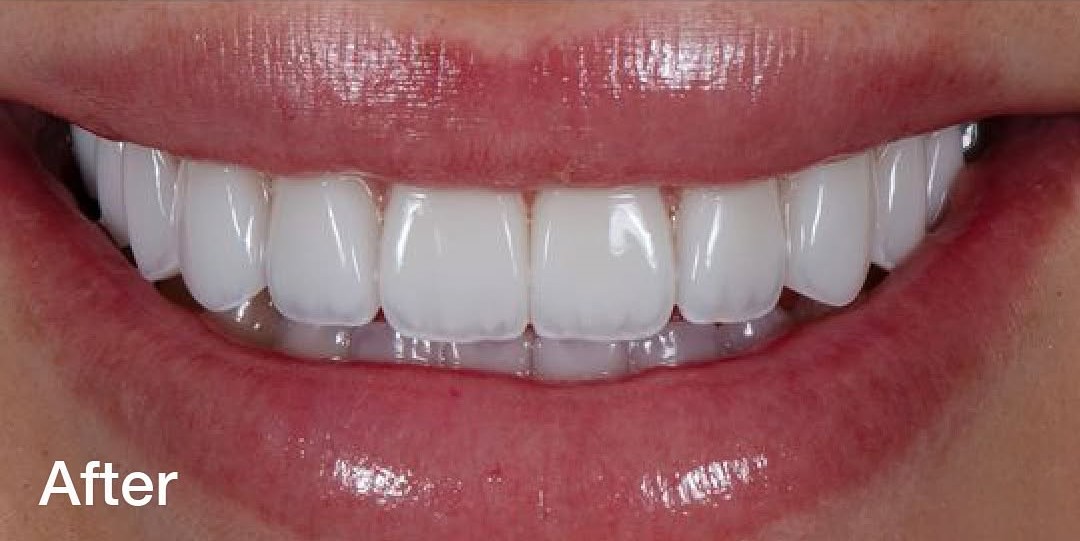 Before treatment - Clinical Case 3