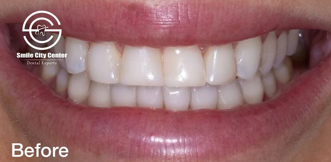 After treatment - Clinical Case 3
