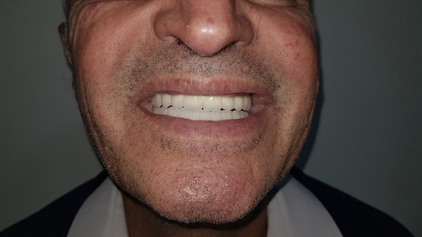 Before treatment - Clinical Case 1