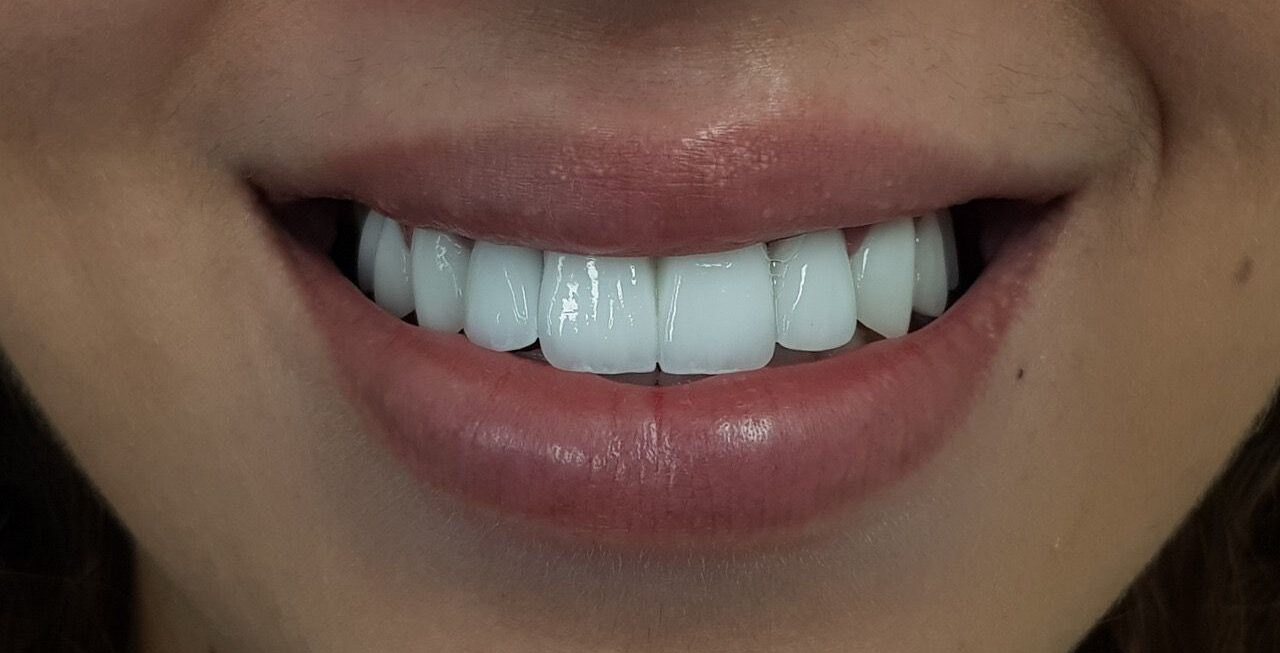 Before treatment - Clinical Case 2