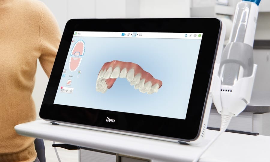 invisalign grid 6 (1)