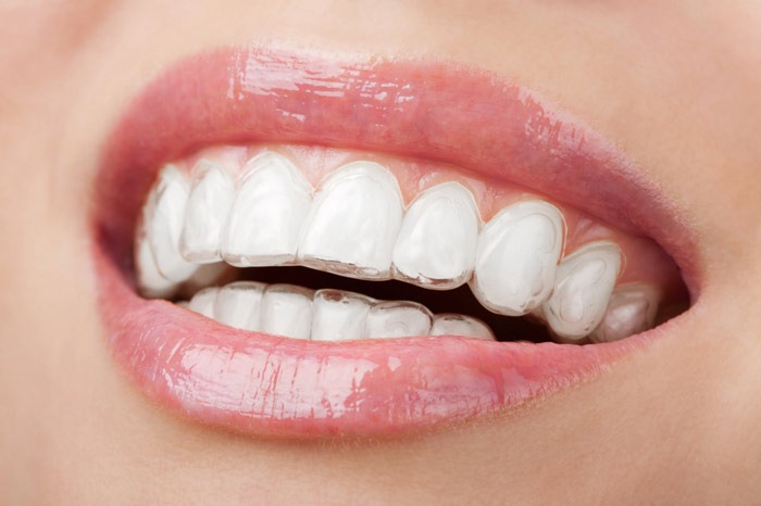Professional smile assessment before cosmetic dental treatment