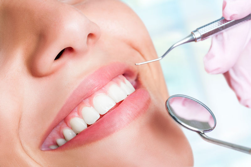Professional in-clinic teeth whitening treatment